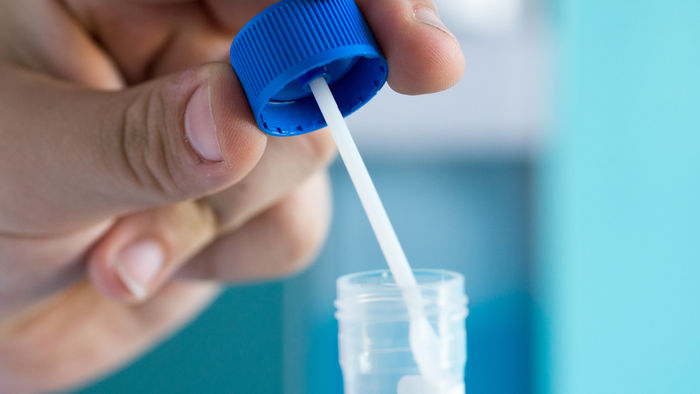DGVS sieht keinen Nutzen von Stuhltests zur Analyse des Darm-Mikrobioms